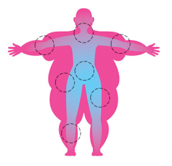  body